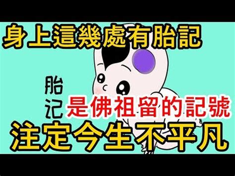 胎記傳說|【胎記是什麼】胎記的秘密大公開！從產生原因、消除。